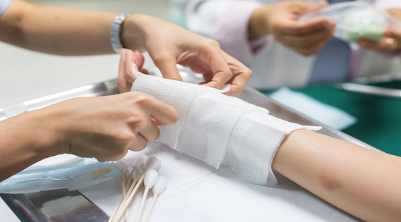 facts-about-burn-injuries-rad-law-firm-dallas-texas-attorneys