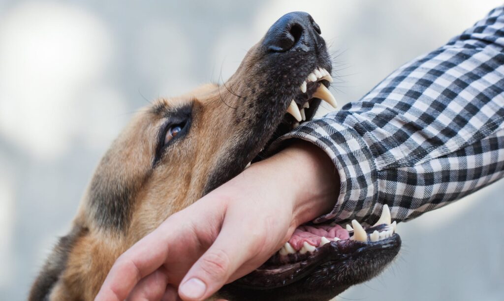 Can You Sue After A Dog Bite Injury In Texas